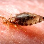 Typhoid fever