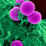 MRSA