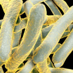 170 people 'likely exposed' to tuberculosis in Long Beach outbreak